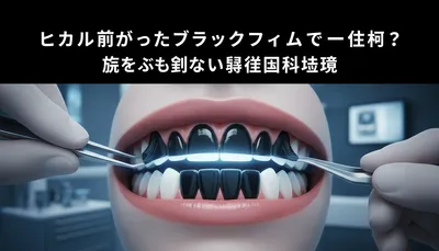 ヒカルが行ったブラックフィルムって一体何？歯をほぼ削らない審美歯科治療
